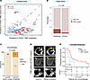 Genomic profiling of TNBC metastases identifies PKD1 as a potential biomark