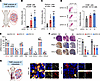 PKD1 promotes an immunosuppressive tumor microenvironment in TNBC.