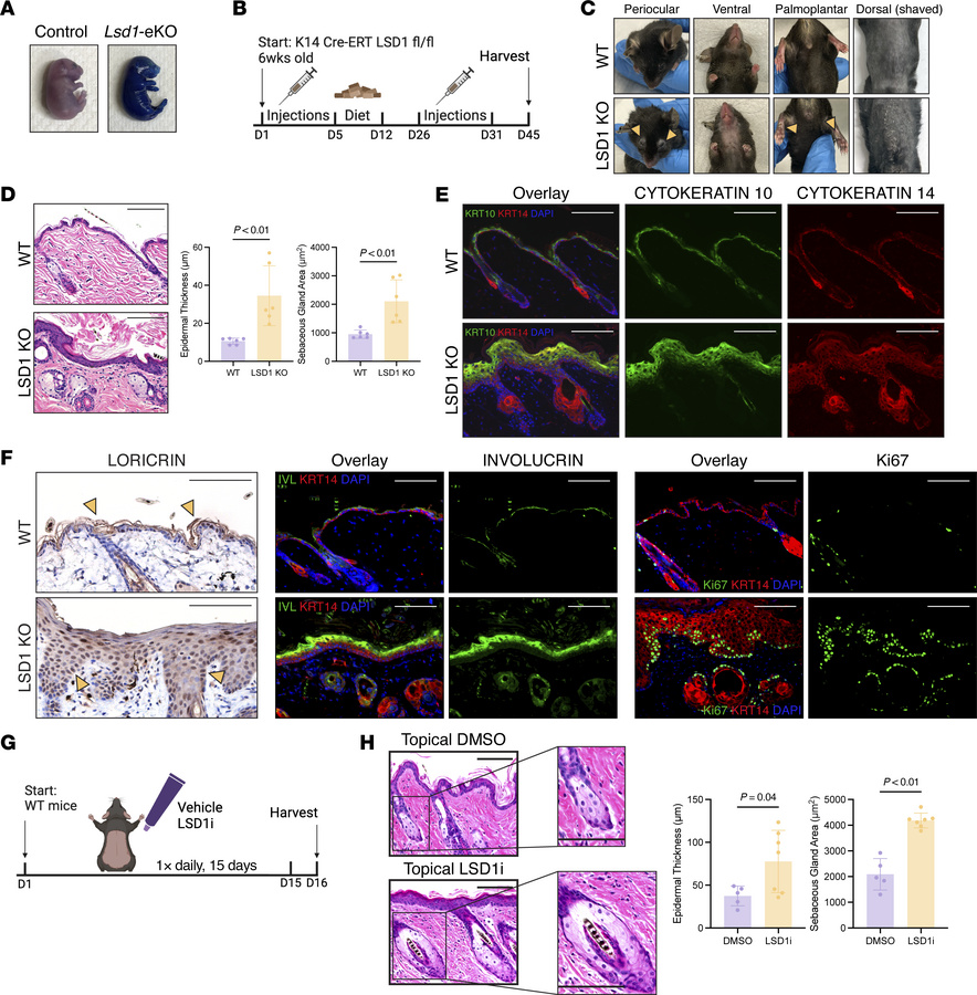 LSD1 is required for epidermal barrier development and maintenance of ad...