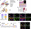 LSD1 loss directs keratinocytes to upregulate RA signaling.