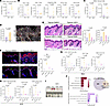 Epidermal phenotypes and immune infiltration upon LSD1 inhibition are depen