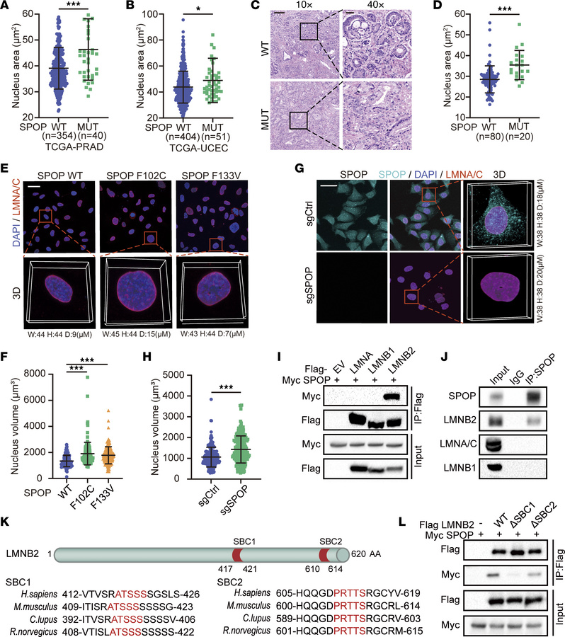 SPOP mutation increases cell nuclear volume.
(A and B) Quantification of...