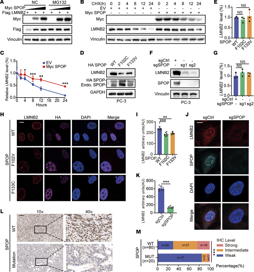 SPOP mutation impairs LMNB2 protein levels.
(A) IB analysis of whole-cel...