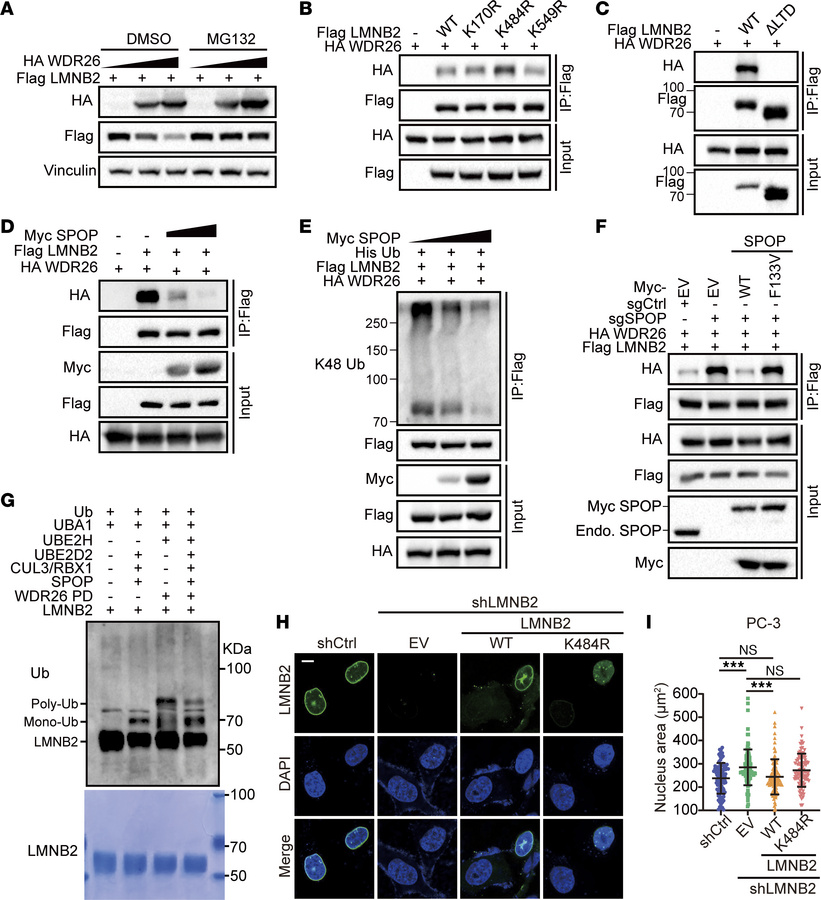 Lys484 mono-ubiquitination stabilizes LMNB2 by antagonizing WDR26-mediat...