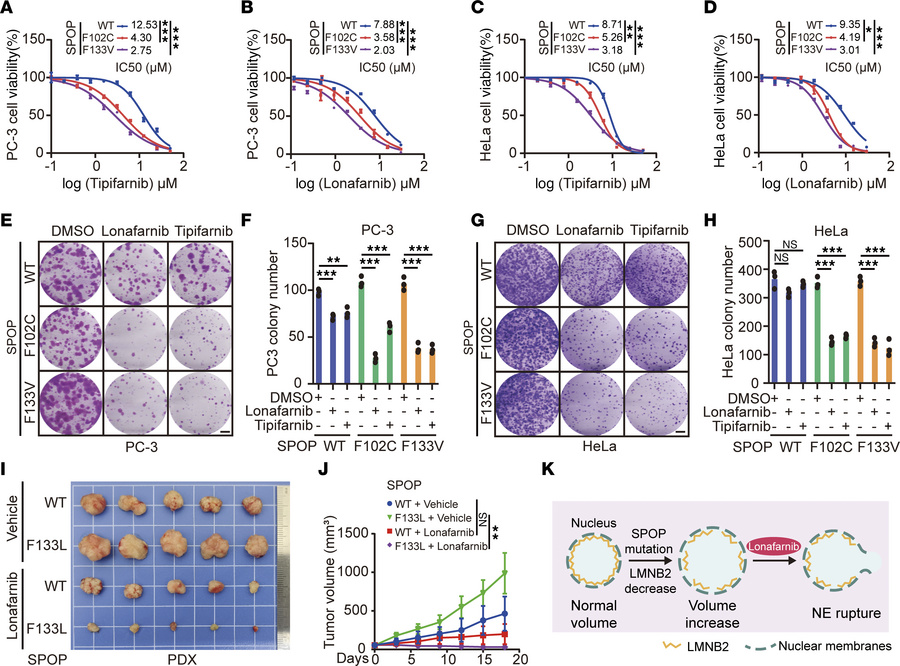 SPOP mutant cells are hypersensitive to farnesyltransferase inhibition.
...