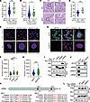 SPOP mutation increases cell nuclear volume.