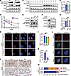 SPOP mutation impairs LMNB2 protein levels.