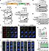 SPOP mutation increases NE rupture risk upon farnesyltransferase inhibition