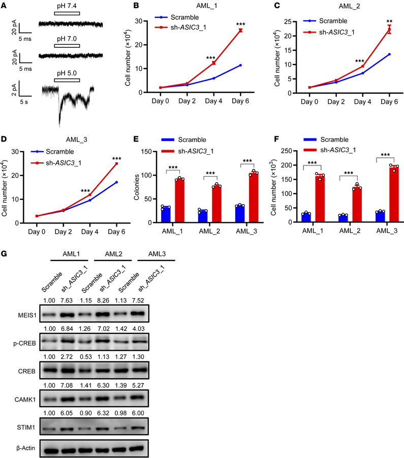 Acid-ASIC3 signaling inhibits the growth of human AML cell lines and LIC...