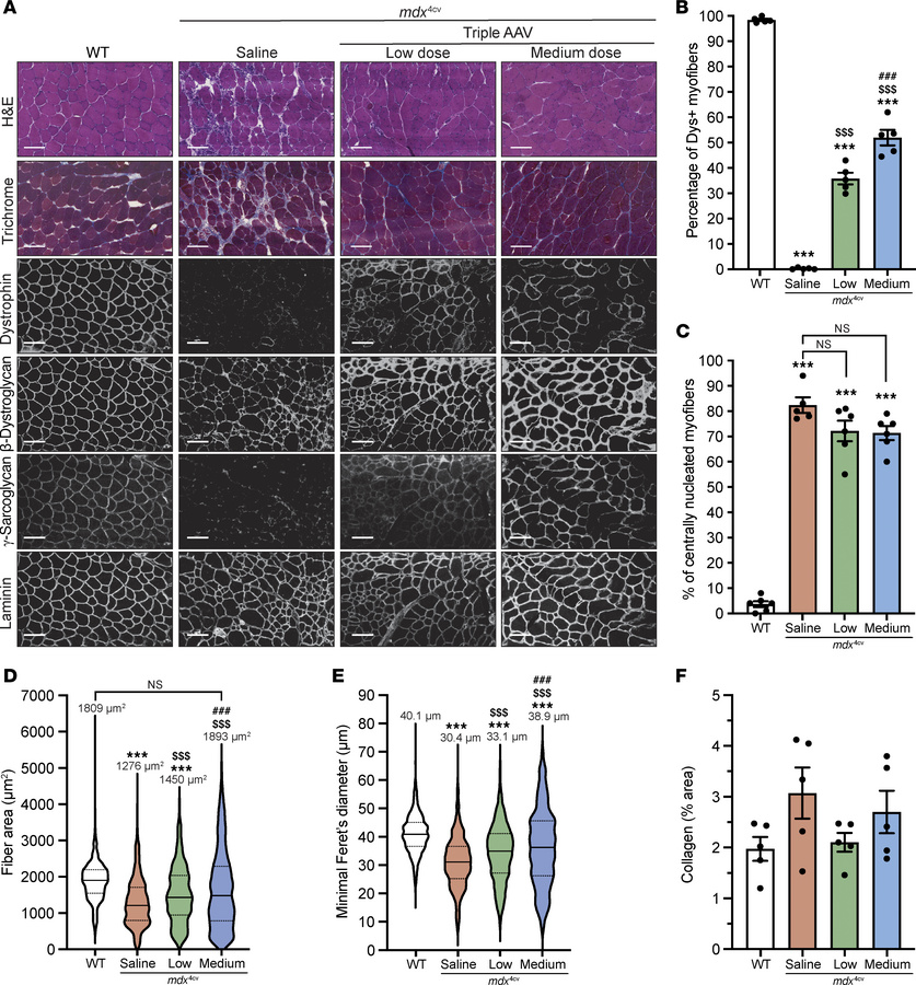 Improvement of TA muscle histology with triple AAV delivery.
(A) TA cros...