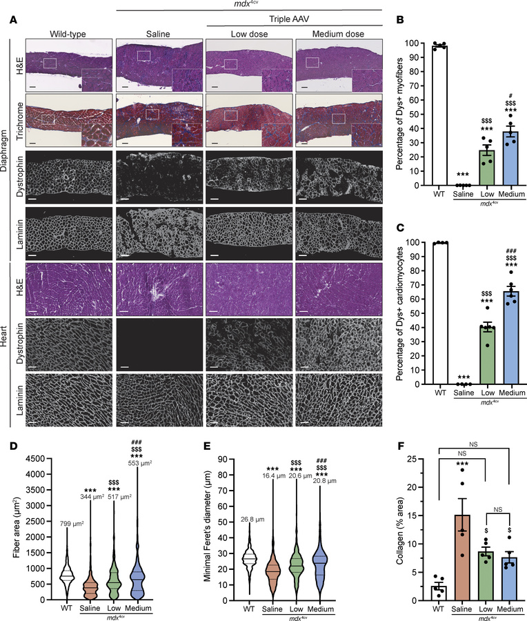 Broad biodistribution of dystrophin expression detected in diaphragm and...