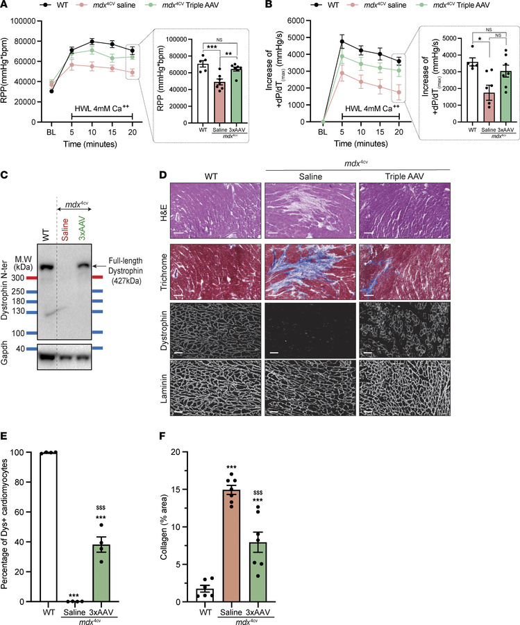 High levels of full-length dystrophin rescue mdx4cvcardiac defects at th...