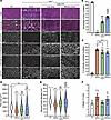 Improvement of TA muscle histology with triple AAV delivery.