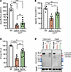 Expression of full-length dystrophin restores TA muscle defects in old and