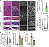 Partial correction of TA muscle histology with triple AAV treatment.