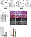 High levels of full-length dystrophin rescue mdx4cvcardiac defects at the l