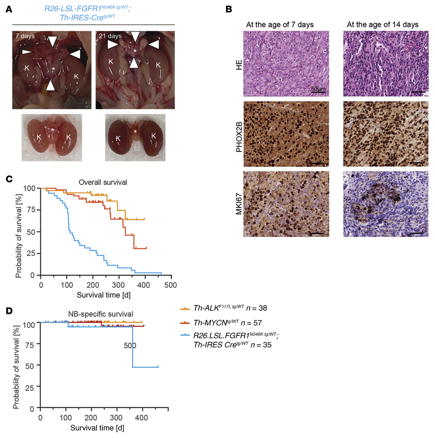 
FGFR1N546K drives neuroblastoma development in a transgenic mouse model...