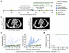Futibatinib shows clinical benefit in a patient with FGFR1-mutated neurobla