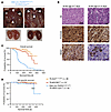 FGFR1N546K drives neuroblastoma development in a transgenic mouse model.