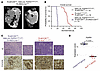 Concurrent expression of FGFR1N546K and MYCN promotes aggressive neuroblast