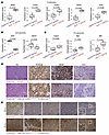FGFR1N546K;MYCN-driven and ALKF1174L;MYCN-driven tumors differ in the expre