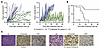 Futibatinib abrogates tumor growth in an FGFR1N546K-mutant, patient-derived