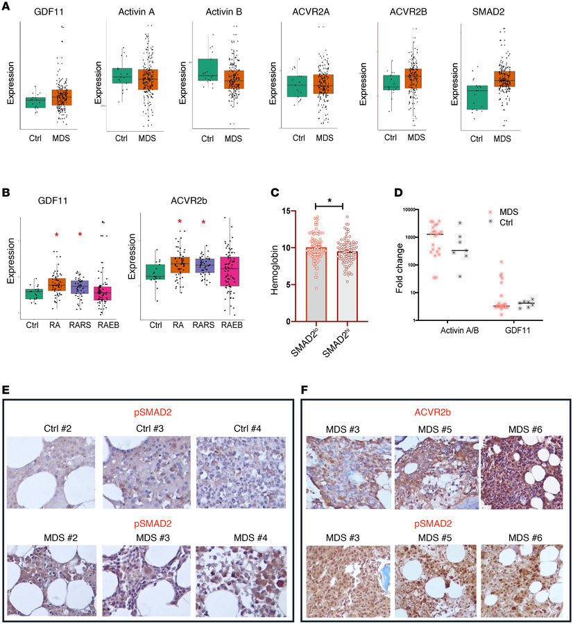 GDF11-SMAD2 signaling is upregulated in samples from patients with MDS.
...