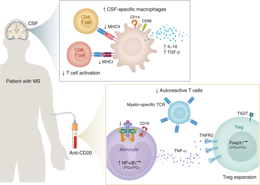 Immune reprogramming in patients with MS by B cell depletion therapy.
B ...