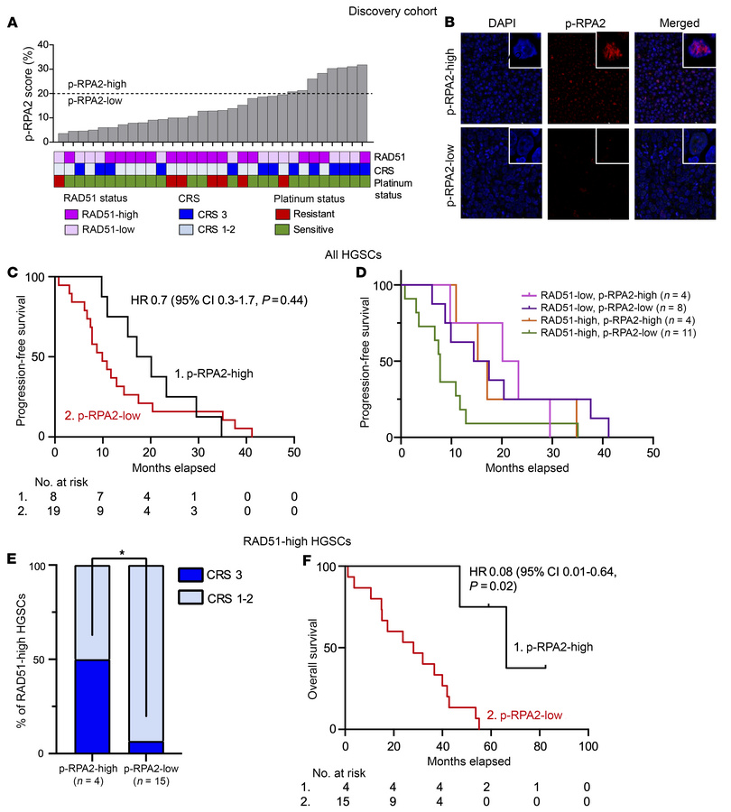 p-RPA2 score predicts therapy response and survival in patients with RAD...