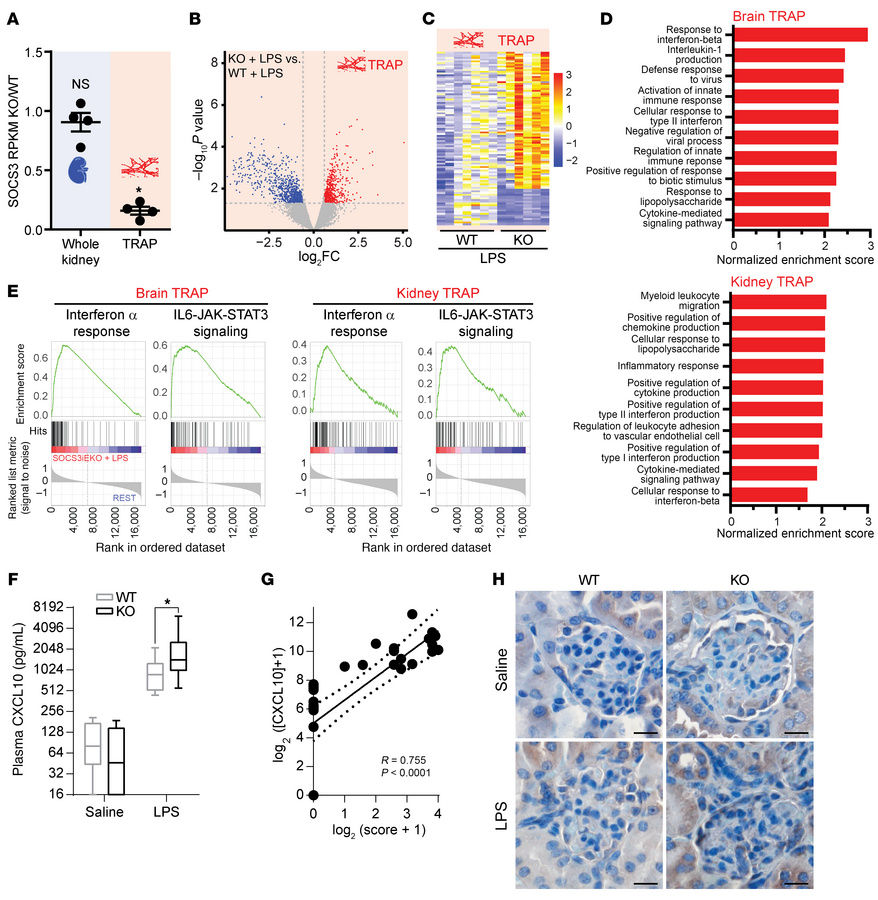 Loss of endothelial SOCS3 promotes a type I IFN–like response to LPS in ...