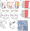 Loss of endothelial SOCS3 promotes a type I IFN–like response to LPS in the