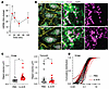 IL-6 leads to mtDNA release.