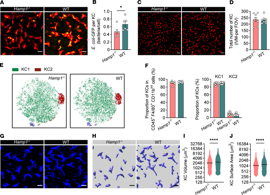 Hepcidin deficiency impairs KCs to clear invading bacteria.
(A) Represen...