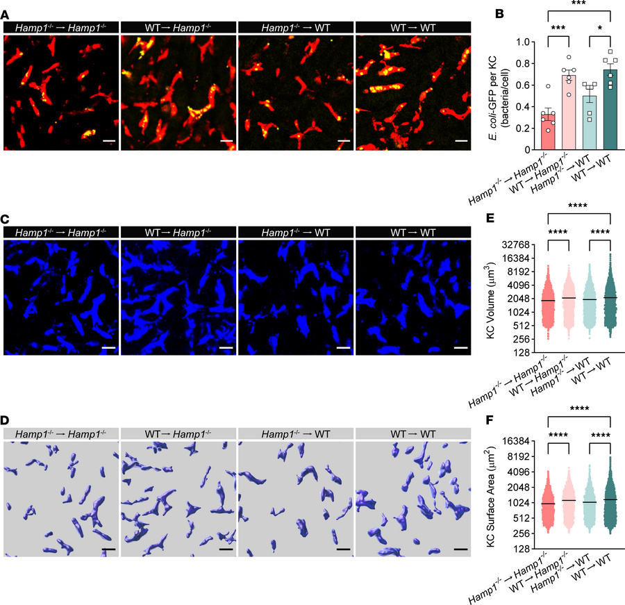 Fecal microbiota transplantation rescues malfunction of KC bacterial cle...