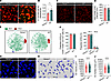 Hepcidin deficiency impairs KCs to clear invading bacteria.