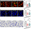 The gut microbiota mediates the malfunction of KC antibacterial defense in