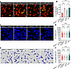 Fecal microbiota transplantation rescues malfunction of KC bacterial cleara