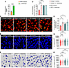 Colonization by IPA-producing L. intestinalis restores hepatic immune defen