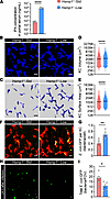 Dietary iron restriction improves KC bacterial clearance and liver immune d