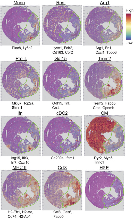 Monocyte-derived populations are spatially distinct.
Spatial transcripto...