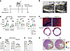 Type 1 IFN signaling in monocytes attenuate post-MI remodeling.