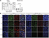 Recruited monocyte-derived populations are concentrated within the infarcte