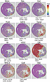 Monocyte-derived populations are spatially distinct.