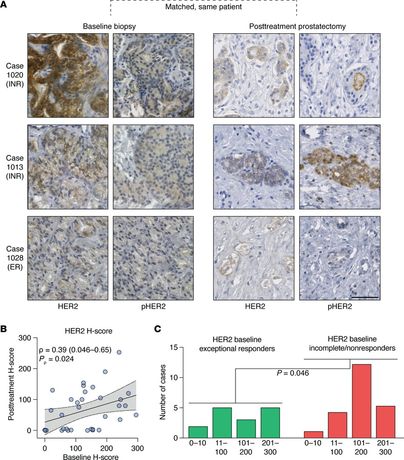 HER2 protein is expressed at baseline in tumor foci that resist therapy ...
