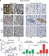 HER2 protein is expressed at baseline in tumor foci that resist therapy and