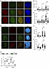 T334 phosphorylation of 53BP1 promotes HR repair of DSBs cont.
