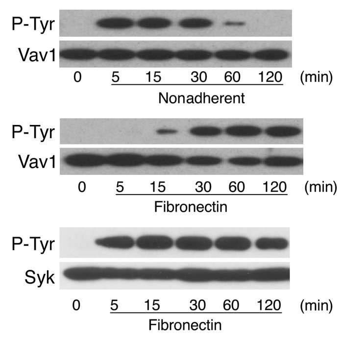 Adhesion of neutrophils to fibronectin leads to delayed Vav1 activation ...