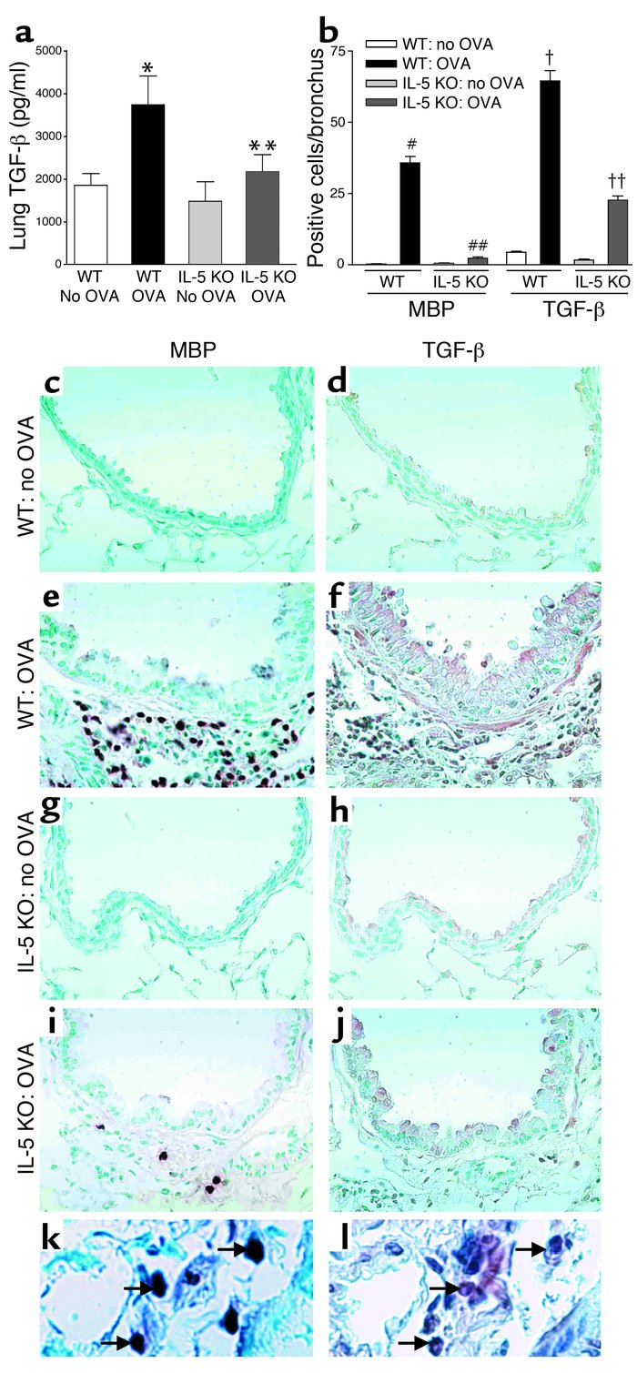 Lung TGF-β1 in WT and IL-5–deficient mice repetitively challenged with O...