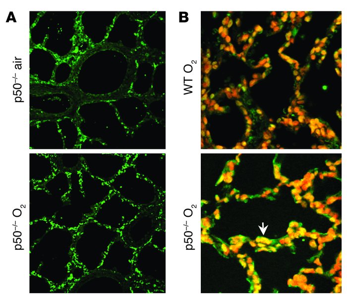 Lung Bcl-2 and TUNEL staining in neonatal p50–/– mice after hyperoxia. (...