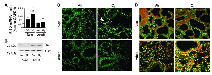 Bcl-2 expression and TUNEL staining in lungs of WT mice exposed to 72 ho...